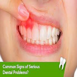 Toothache, Stained Teeth, Cavities , Chipped Tooth, Impacted Teeth , Cracked Tooth , Sensitive to Cold , Too Many Teeth 